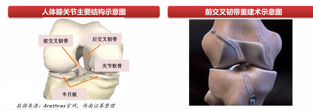 膝關(guān)節(jié)結(jié)構(gòu)